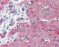 CLDN1 / Claudin 1 Antibody (C-Terminus)